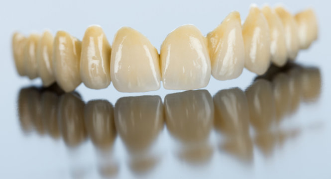 Porcelain dental bridge on mirror surface