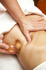 Fototapeta na wymiar Anti cellulite massage with Ventuza vacuum body puller