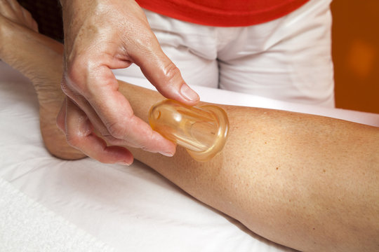 Anti cellulite massage with Ventuza vacuum body puller