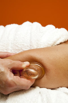 Anti cellulite massage with Ventuza vacuum body puller