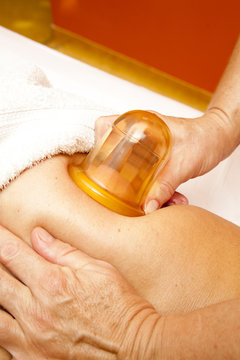Anti cellulite massage with Ventuza vacuum body puller
