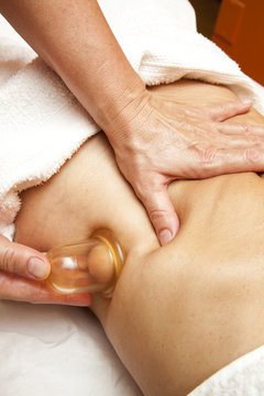 Anti cellulite massage with Ventuza vacuum body puller