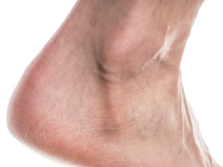 Male ankle towards white