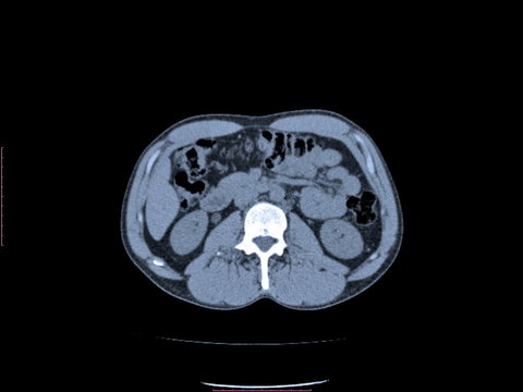 CT Scan Video Slide Animations. Abdominal cross section slices o