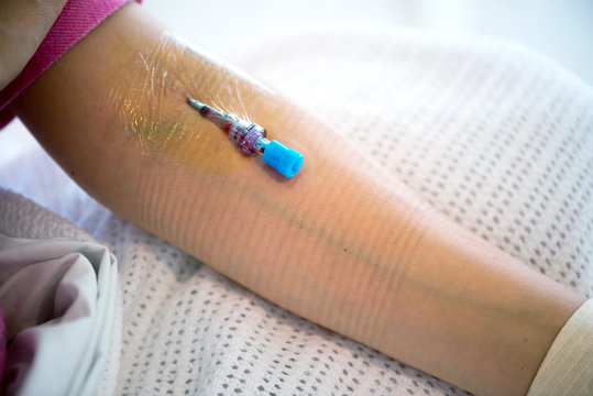 Cannula or catheter in the vein