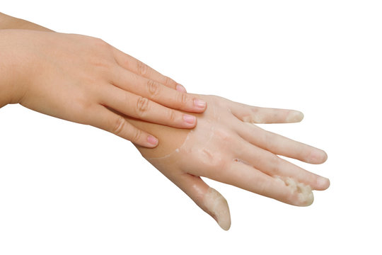 spa hand treatment and beauty,Hand in paraffin bath ,woman recei