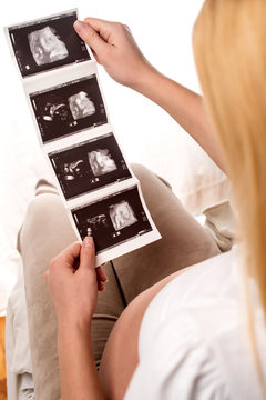 Pregnant woman holding ultrasound baby scan
