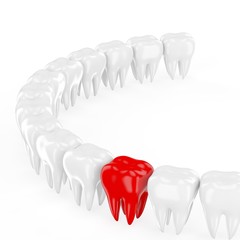 Aching tooth in row of healthy teeth. 3d