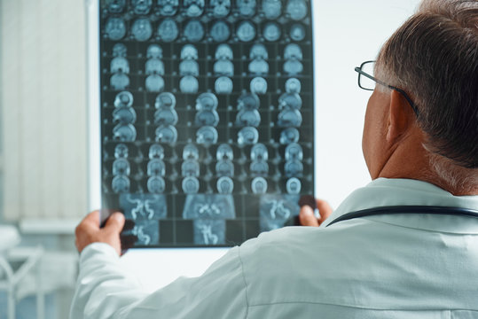 Unrecognizable senior doctor examines MRI image