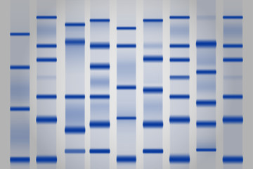 Gel electrophoresis separation electrophoretogram