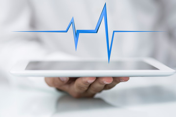 ecg