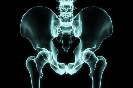 X-ray hip