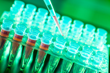 Laboratory research of cancer diseases,  rack with RNA samples