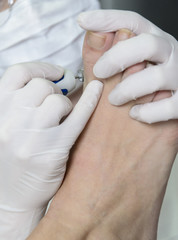 Pedicure treatment