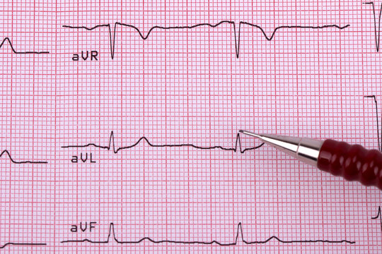 Healthy Heart cardiogram