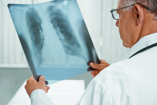 Unrecognizable older doctor is analyzing x-ray image