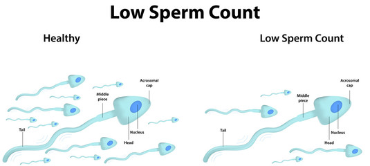 Low Sperm Count