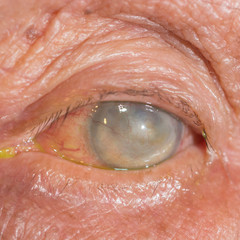 Fototapeta premium Eye exam