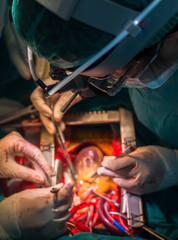cardiac surgeon