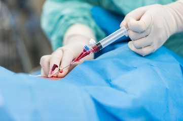 puncture internal carotid vein for central venous pressure