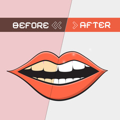 Retro Vector Mouth Illustration - Cleaning Teeth Symbol