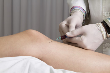 Closeup of doctor injecting platelet rich plasma to knee