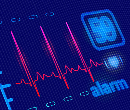 LCD Medical Heart Monitor With ECG Wave. Close-up Detailed Vecto