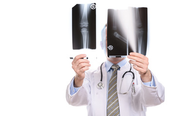 Chirurg oder Radiologe vergleicht Röntgenbilder