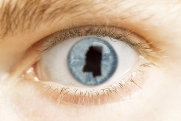 Close-up of an eye with the pupil in the shape of Mississippi.(s