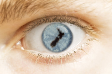 Close-up of an eye with the pupil in the shape of New Zealand.(s