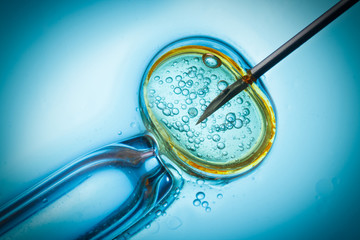 In vitro fertilisation, IVF macro concept - 67275727
