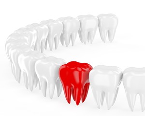 Aching tooth in row of healthy teeth. 3d