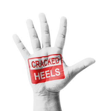 Open hand raised, Cracked Heels sign painted