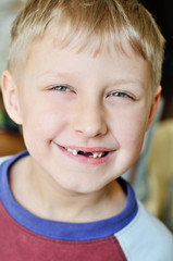 little boy lost milk tooth