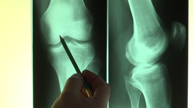 Reading X-Rays - Full HD