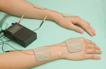 Electrodes  device on shoulder, transcutaneous interferential el