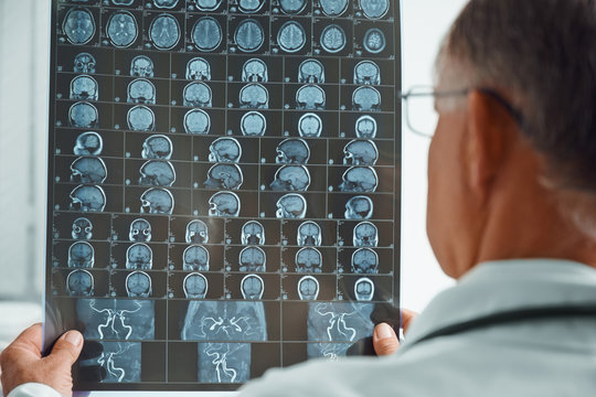 Unrecognizable older doctor examines MRI image