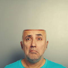 sad senior man with open head