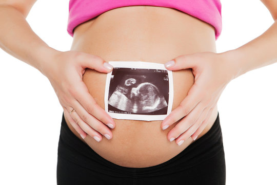 Pregnant woman holding ultrasound examination picture, isolated