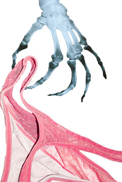 Pervers Skelleton