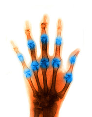 X-Ray scan human for hand