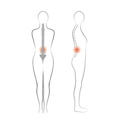 Vector woman body shape. Vertebrae pain.