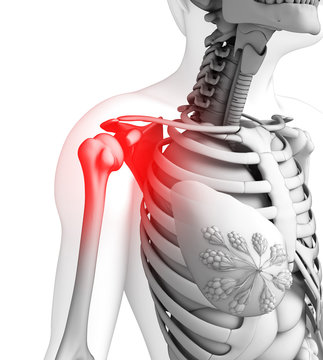 Human shoulder pain artwork