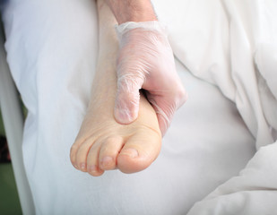 doctor examines foot of heavy patient with edema