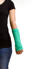 green cast on hand and arm isolated on white background
