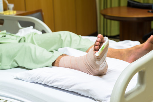 Patient with broken leg in cast and bandage