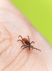 Castor bean tick, Ixodes ricinus crawling on human skin