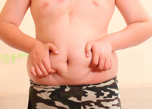 boy 11 years ill obese. metabolic disorder