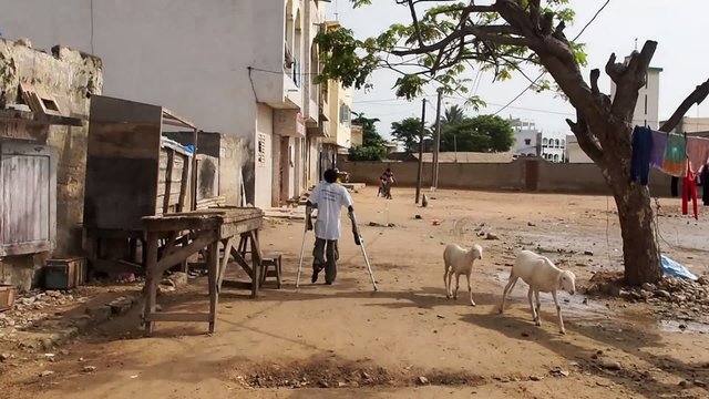 African girl with the poliomyelitis