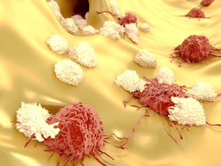Cancer cells attacked by lymphocytes